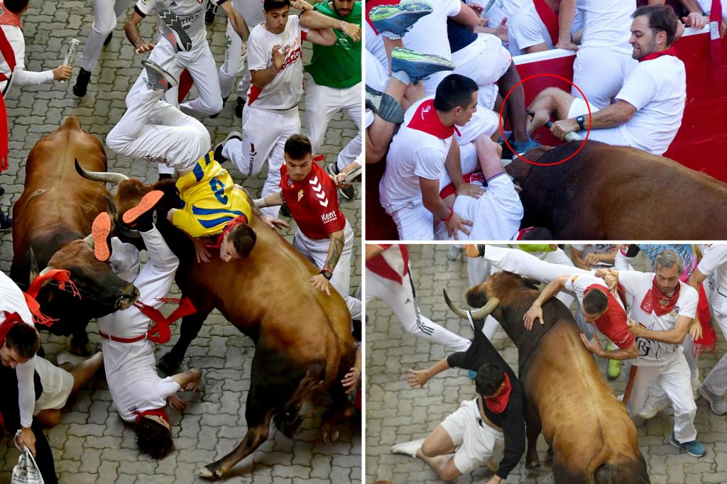 Shocking photos show a Florida man’s torn leg in the Pamplona bull run